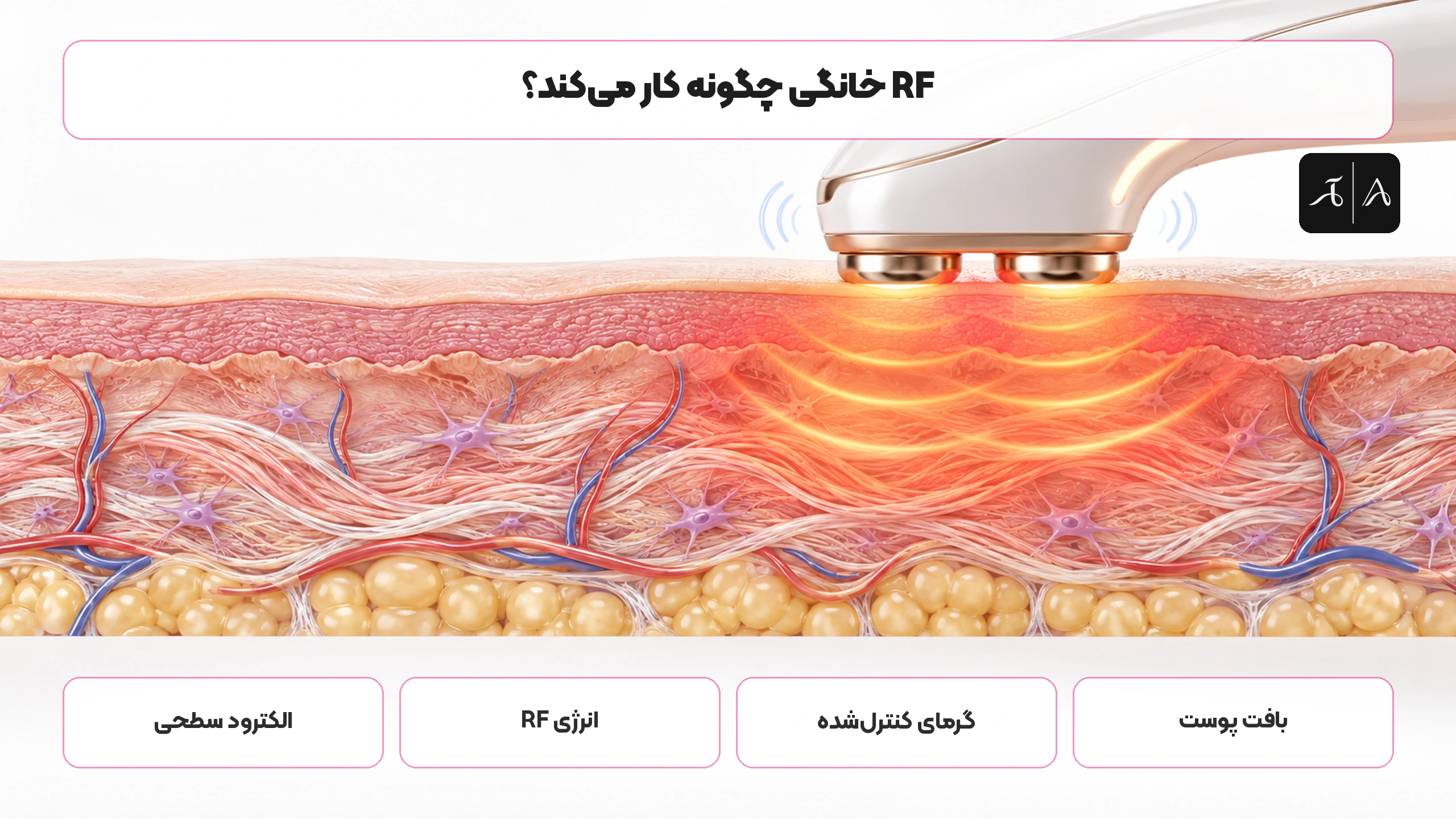 نحوه انتقال انرژی و گرمای کنترل‌شده در دستگاه RF خانگی