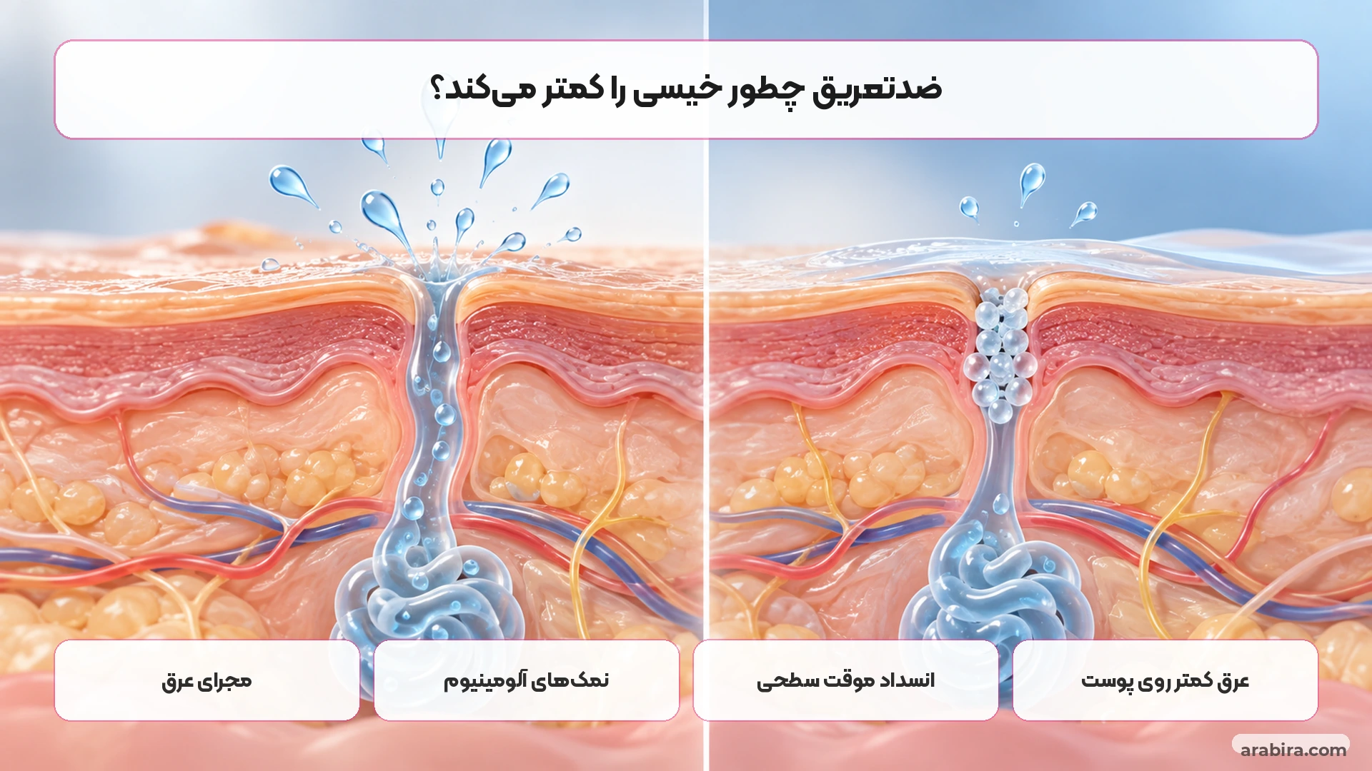 مکانیسم ساده ضدتعریق آلومینیومی در کاهش موقت خروج عرق
