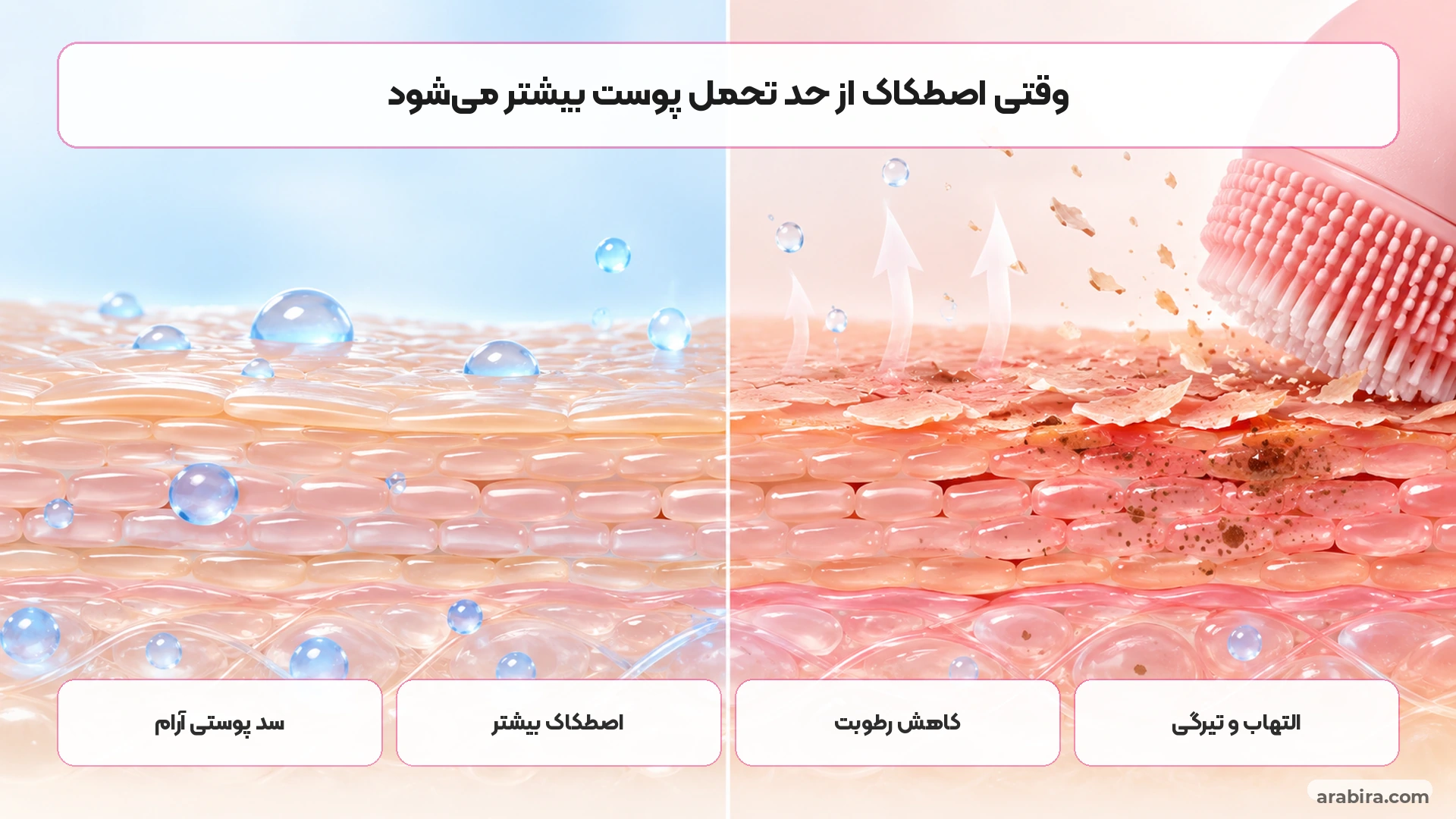 مقایسه مفهومی پوست آرام با پوست تحریک‌شده بر اثر اصطکاک و لایه‌برداری مکانیکی شدید