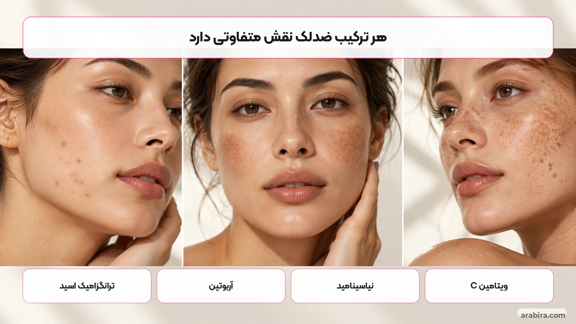 مقایسه ترکیبات رایج ضدلک شامل ترانگزامیک اسید، آربوتین، نیاسینامید و ویتامین C