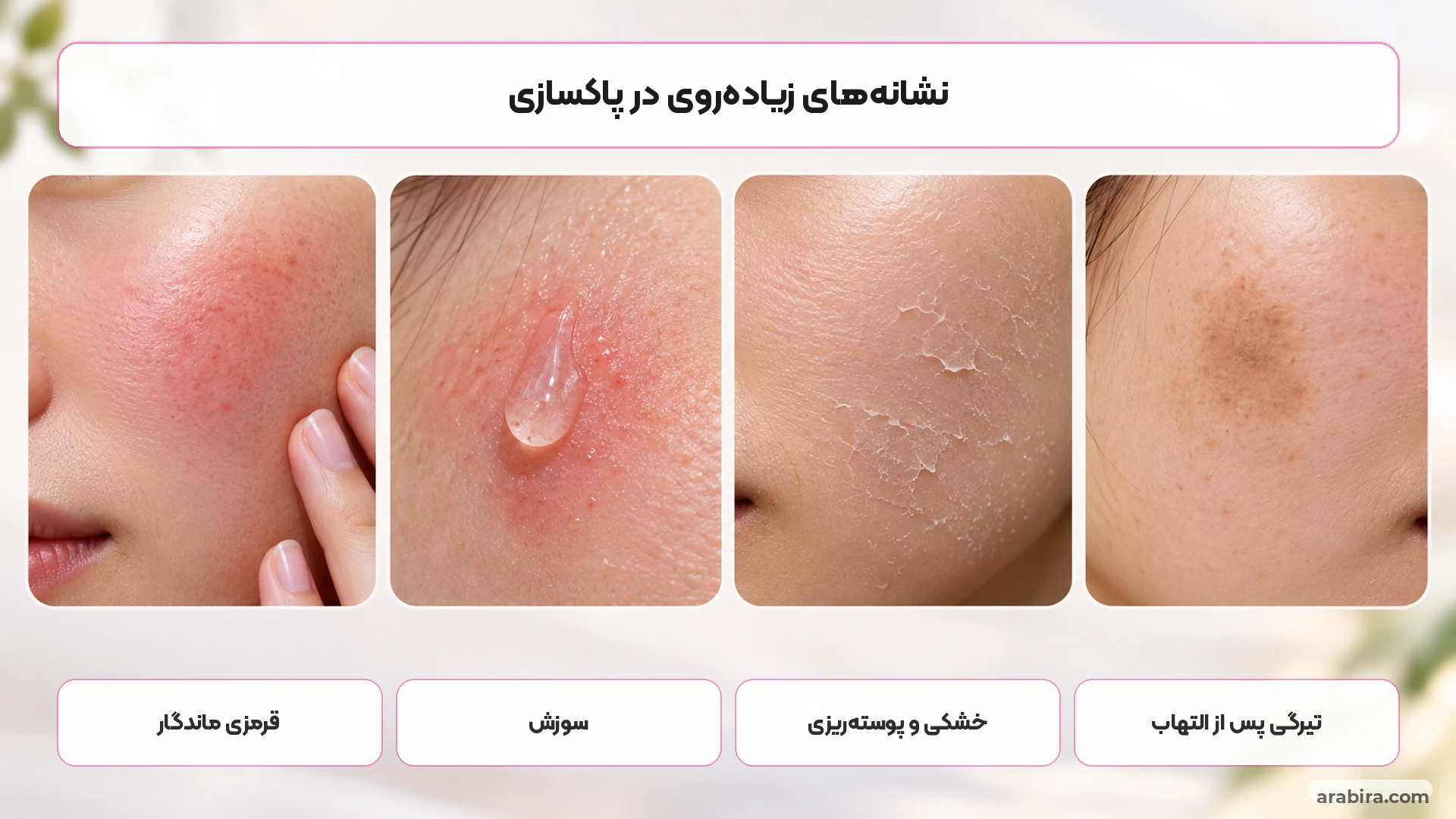 نشانه‌های تحریک پوست پس از استفاده بیش از حد از برس و لایه‌برداری مکانیکی