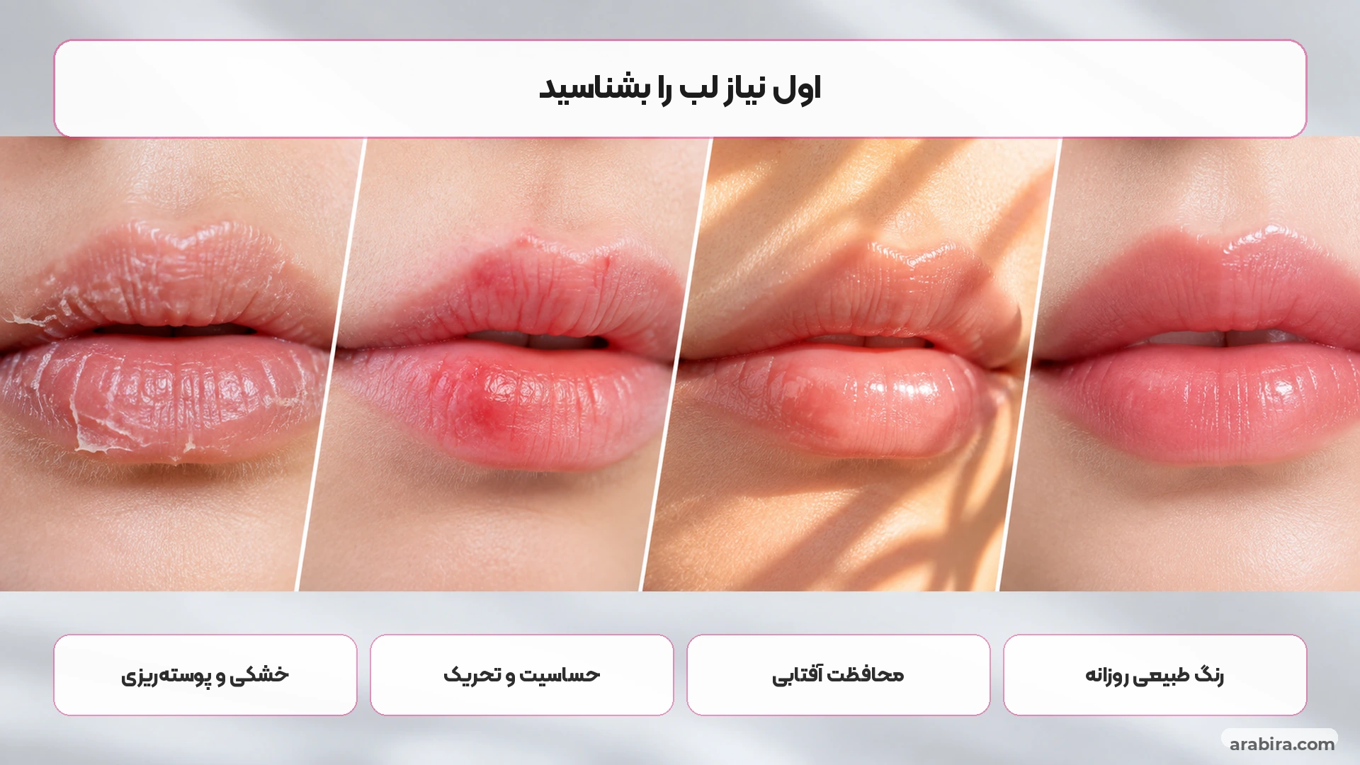مقایسه تصویری خشکی لب، حساسیت، نیاز به محافظت آفتابی و استفاده آرایشی روزانه