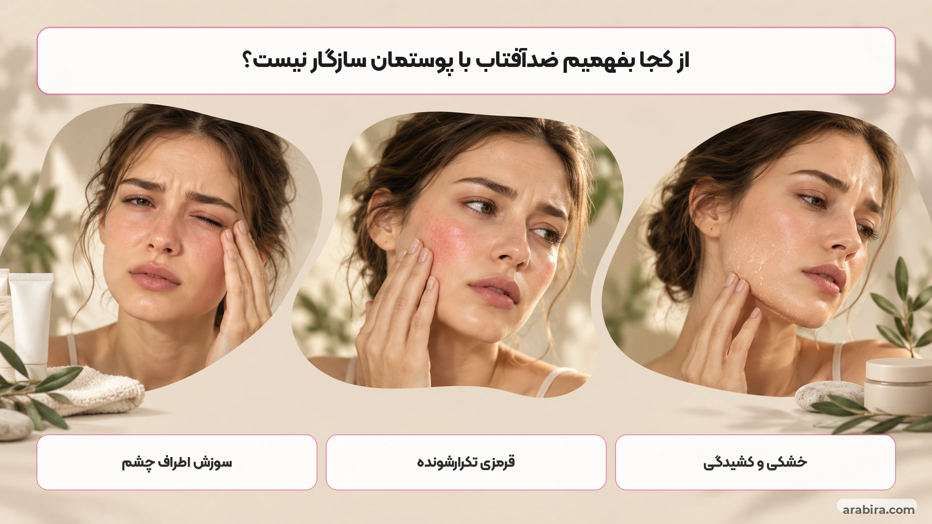 نشانه‌های سوزش و تحریک پوست حساس پس از استفاده از ضدآفتاب