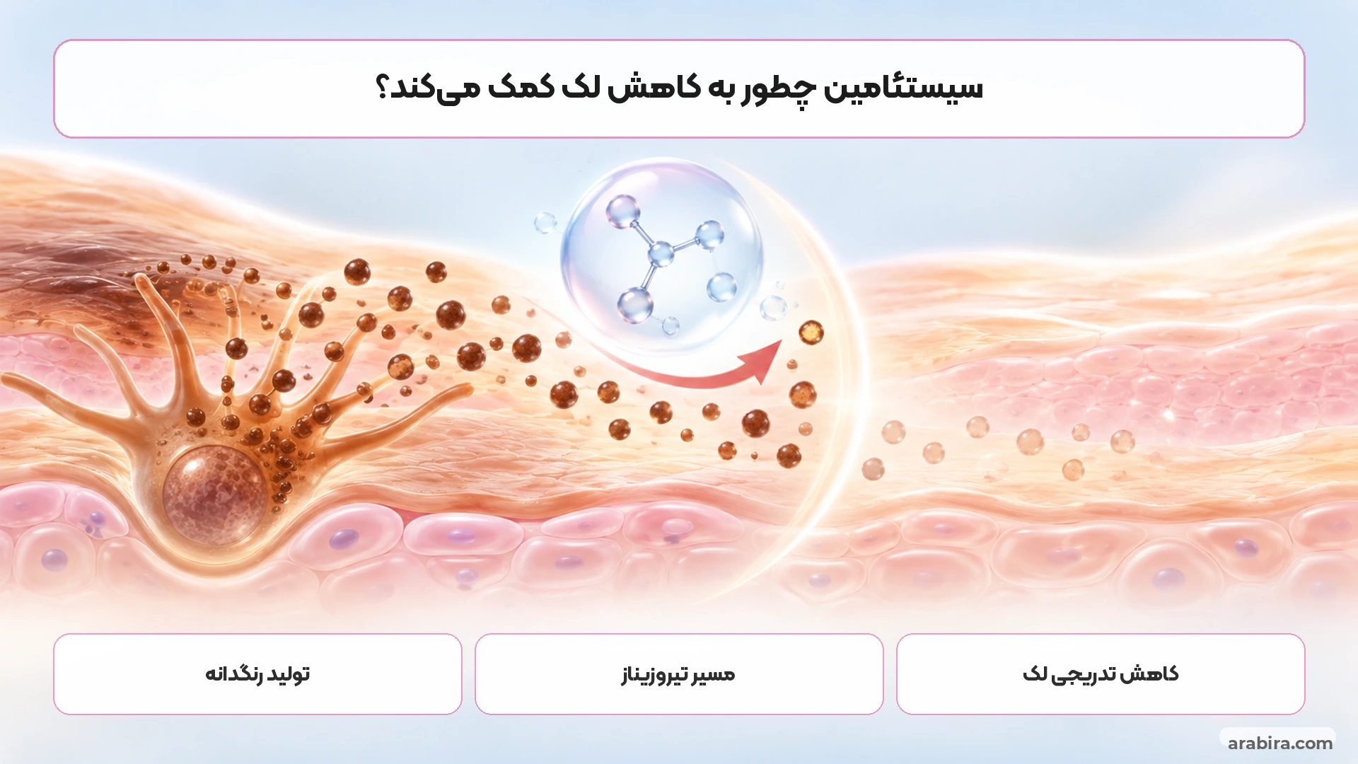 اینفوگرافیک ساده مسیر تولید ملانین و اثر سیستئامین بر ایجاد لک