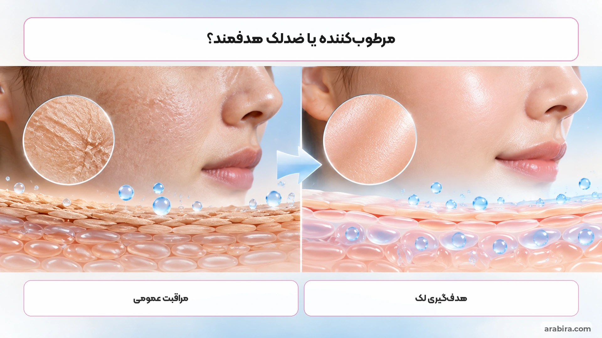 مقایسه کرم ژل رویال با مراقبت هدفمند برای لک صورت