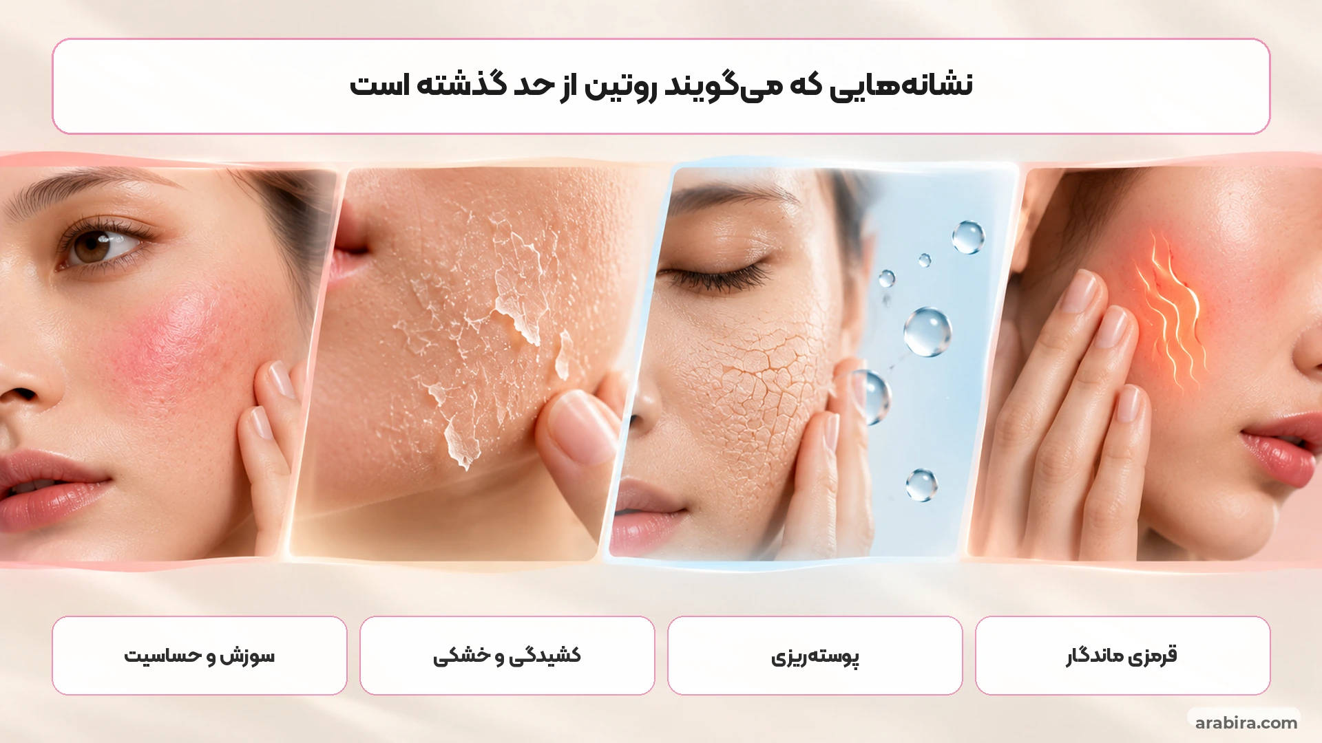 نشانه‌های تصویری لایه‌برداری بیش از حد شامل قرمزی، خشکی و سوزش پوست